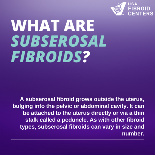 Subserosal Fibroid