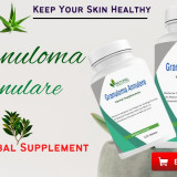 5-Ways-to-Get-Rid-of-Granuloma-Annulare-Naturally