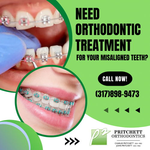 Looking for an affordable orthodontist? Pritchett Orthodontics provides incorporates modern treatments unique to each patient’s individual needs with friendly service. We have advanced techniques and spend 100% of our time helping patients achieve healthier smiles, better self-esteem, and treating bad bites. Make an appointment today!