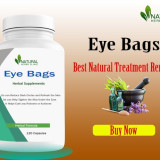 Eye-Bags-Home-Remedies