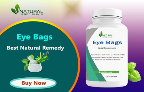 Do you want to get rid of those pesky eye bags? Check out these Home Treatments for Eye Bags to help reduce puffiness, and dark circles… https://www.natural-health-news.com/eye-bags-home-treatments-best-option-to-recover-it-naturally/