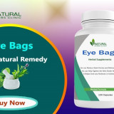 Eye-Bags-Natural-Supplements