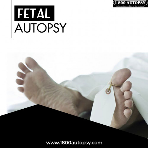 FETAL-AUTOPSY.jpg