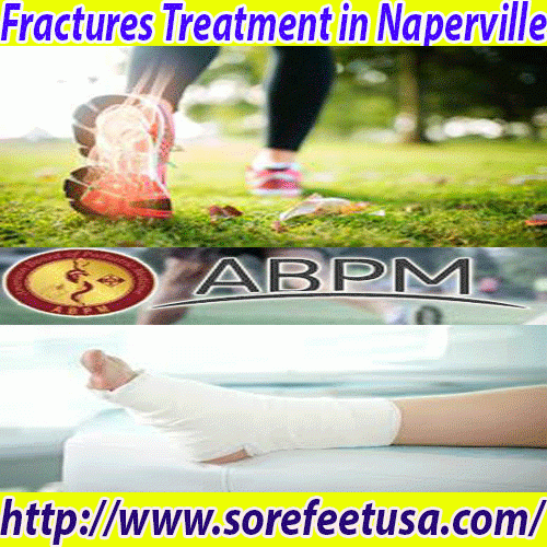 Fractures Treatment in Naperville