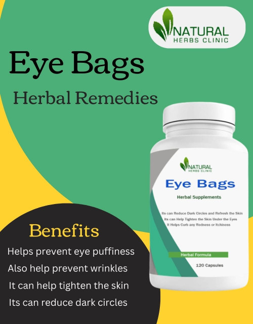 Are you looking for Home Remedies for eye bags? If yes, then you should definitely try out the range of herbal supplements from Natural Herbs Clinic. https://www.naturalherbsclinic.com/blog/home-remedies-for-eye-bags-effective-treatment-by-natural-herbs-clinic/