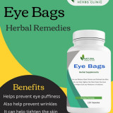 Herbal-Remedies-for-Eye-Bags