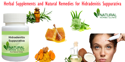 Cold Compress is one of the helpful Natural Remedies for Hidradenitis Suppurativa that works properly without any side effects... http://naturalherbsclinic.altervista.org/helpful-natural-remedies-for-hidradenitis-suppurativa/