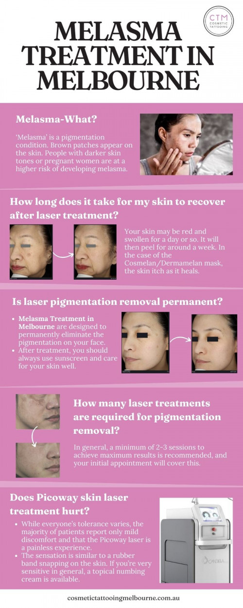 Melasma is a skin pigmentation condition that affects many women. Our laser treatment is designed to permanently eliminate the hyperpigmentation on your face. Get in touch with us today and visit the website https://cosmetictattooingmelbourne.com.au/melasma-laser-treatment/

#CosmeticTattooingMelbourne #cosmetictattooing #melasmatreatmentmelbourne #skinlasertreatmentsmelbourne