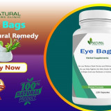 Natural-Remedies-for-Eye-Bags