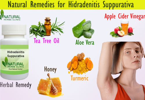 You can blend the pure honey with turmeric powder and apply it to the influenced region it tends to be an extremely successful Natural Remedies for Hidradenitis Suppurativa. Apply for 30 minutes prior to washing it off... https://sites.google.com/view/hidradenitissuppurativaremedy/home