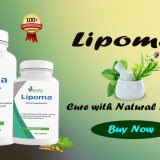 Natural-Remedies-for-Lipoma