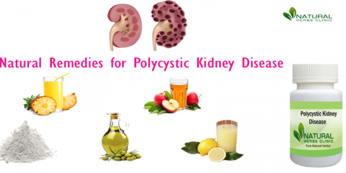 Baking soda is one of the well-known Natural Remedies for Polycystic Kidney Disease. It can help the kidney to create more bicarbonate. Add 1 tablespoon of baking soda to an 8-drops glass of water and Dissolve it well. Attempt to taste it gradually day by day. As it's a powerful home cure for how to deal with kidney disorders naturally... https://sites.google.com/view/treatmentofpolycystickidney/home