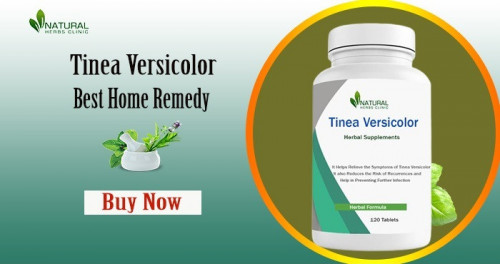 Our Natural Supplements for Tinea Versicolor contain vitamins and minerals that can help to boost your immune system and help fight off the yeast that causes this condition. https://romanibook.com/read-blog/5882_tinea-versicolor-natural-supplements-that-help-to-fight-the-disease.html