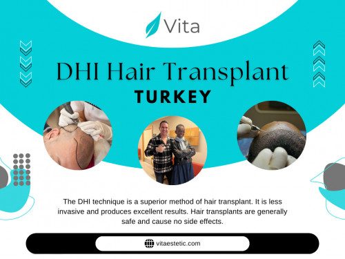 As you contemplate booking your DHI hair transplant Turkey session, the allure of a minimally invasive marvel beckons. Beyond the scalpel, DHI represents a leap forward in the field of hair restoration, offering precision, natural results, and a patient-centric approach. With this innovative technique, the journey to a fuller head of hair becomes not only a cosmetic enhancement but a transformative experience with minimal disruption to your daily life. 

Official Website: https://vitaestetic.com/

Click here for More Information: https://vitaestetic.com/dhi-hair-transplant-in-turkey/

Call Us: +90 544 363 39 91

Our Profile: https://gifyu.com/vitaestetic

More Photos: 

http://tinyurl.com/2bet9zr4
http://tinyurl.com/2844lpzx
http://tinyurl.com/2bwy5jrh
http://tinyurl.com/2dktwgfj