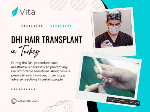 Before you book your session for ⁠⁠DHI hair transplant in Turkey, knowing what the future holds in the realm of hair restoration can make all the difference. Welcome to the realm of DHI - a revolutionary approach that goes beyond the traditional scalpel, offering a minimally invasive marvel in the world of hair transplants. In this blog, we'll dive into the intricacies of DHI hair transplants, exploring why this cutting-edge technique is gaining popularity as the go-to solution for those seeking a fuller head of hair with minimal downtime and maximum natural results.

Official Website: https://vitaestetic.com/

Click here for More Information: https://vitaestetic.com/dhi-hair-transplant-in-turkey/

Call Us: +90 544 363 39 91

Our Profile: https://gifyu.com/vitaestetic

More Photos: 

https://is.gd/8rAyJ9
https://is.gd/3I5TZl
https://is.gd/b6BCOg
https://is.gd/an847M