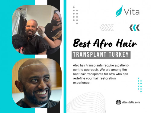 Preparation is a key component of a successful Best Afro hair transplant Turkey journey. From detailed consultations with your surgeon to blood tests, managing medications, and making lifestyle adjustments, each step plays a crucial role in ensuring a smooth and effective procedure. By taking these preparatory measures seriously, you contribute to creating an optimal environment for the transplant, setting the stage for natural-looking and long-lasting results. 

Official Website: https://vitaestetic.com/

Click here for More Information: https://vitaestetic.com/afro-hair-transplant-in-turkey/

Call Us: +90 544 363 39 91

Our Profile: https://gifyu.com/vitaestetic

More Photos: 

https://is.gd/8rAyJ9
https://is.gd/3I5TZl
https://is.gd/an847M
https://is.gd/H8oskW
