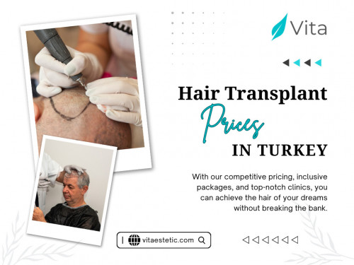 Embarking on the journey of hair transplant consideration often comes with questions about the associated costs. It's essential to recognize that the Hair transplant prices in Turkey can vary widely depending on several factors. By understanding these elements, individuals can better comprehend the financial aspects of the procedure and make choices aligned with their budget and expectations.

Official Website: https://vitaestetic.com/

Click here for More Information: https://vitaestetic.com/cost-of-hair-transplant-in-turkey/

Call Us: +90 544 363 39 91

Our Profile: https://gifyu.com/vitaestetic

More Photos: 

https://is.gd/0JxAUQ
https://is.gd/SoeHJg
https://is.gd/qwWRcI
https://is.gd/68gCTl