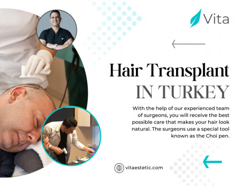In recent years, the decision to undergo a hair transplant has transcended mere aesthetic concerns. More than just a remedy for receding hairlines or bald patches, opting for a hair transplant in Turkey has become a transformative journey for individuals seeking to revitalize not just their looks, but their overall confidence and self-esteem. This blog delves into the motivations behind the choice to undergo a hair transplant, shedding light on the multifaceted reasons that drive people to make this life-altering decision.

Official Website: https://vitaestetic.com/

Click here for More Information: https://vitaestetic.com/dhi-hair-transplant-in-turkey/

Call Us: +90 544 363 39 91

Our Profile: https://gifyu.com/vitaestetic

More Photos: 

https://is.gd/0JxAUQ
https://is.gd/qcOu6E
https://is.gd/qwWRcI
https://is.gd/68gCTl