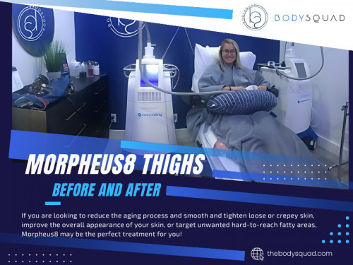 Understanding the procedure, its benefits, and limitations will help you make an informed decision about whether to proceed with Morpheus8 treatment.
Also, ask for the photos of Morpheus8 thighs before and after especially targeting thighs to better visualize potential outcomes and determine if they align with your expectations.

To learn more about our services, Check out our website: https://thebodysquad.com/skin-tightening

Find us on Google Maps: http://maps.app.goo.gl/BSS6Wq9JnG1qFvKAA

Look at our Google Business site: https://bodysquad.business.site

Contact Now: BodySquad
Address: 151 E Palmetto Park Rd, Boca Raton, FL 33432, United States
Phone: +1 561-903-4945

Our Profile: https://gifyu.com/thebodysquad
More Images: http://tinyurl.com/28yr6p2b
http://tinyurl.com/277cqa8a
http://tinyurl.com/24o2zvq7
http://tinyurl.com/24absocn