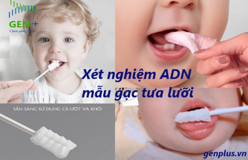 Trong kỷ nguyên công nghệ tiên tiến, xét nghiệm ADN đã trở thành một công cụ vô cùng hữu ích trong nhiều lĩnh vực. Một trong những phương pháp xét nghiệm ADN đang được áp dụng rộng rãi hiện nay là xét nghiệm mẫu gạc tưa lưỡi.

Xét nghiệm ADN mẫu gạc tưa lưỡi là một thủ thuật không xâm lấn, cho phép thu thập mẫu tế bào từ niêm mạc miệng. Mẫu này sau đó được phân tích để xác định cấu trúc di truyền của cá nhân.

Ưu Điểm của Xét Nghiệm ADN Mẫu Gạc Tưa Lưỡi

Phương pháp xét nghiệm này mang lại nhiều lợi ích đáng kể:

 Tính riêng tư: Mẫu gạc tưa lưỡi có thể được thu thập một cách kín đáo, không để lại dấu vết. Điều này rất phù hợp với những trường hợp không muốn gây sự chú ý hoặc ảnh hưởng đến cuộc sống cá nhân.
 Tính chính xác: Xét nghiệm ADN mẫu gạc tưa lưỡi cung cấp kết quả chính xác cao, tương đương với các phương pháp xét nghiệm ADN khác.
 Không xâm lấn: Thủ thuật thu thập mẫu không gây đau đớn hoặc khó chịu.

Ứng Dụng của Xét Nghiệm ADN Mẫu Gạc Tưa Lưỡi

Xét nghiệm ADN mẫu gạc tưa lưỡi được sử dụng trong nhiều mục đích khác nhau, bao gồm:

 Xác định quan hệ cha con
 Xác định danh tính
 Nghiên cứu phả hệ
 Chẩn đoán bệnh di truyền

Độ Tin Cậy của Xét Nghiệm ADN Mẫu Gạc Tưa Lưỡi

Độ tin cậy của xét nghiệm ADN mẫu gạc tưa lưỡi đã được chứng minh qua nhiều nghiên cứu khoa học. Các phòng xét nghiệm uy tín sử dụng các tiêu chuẩn nghiêm ngặt để đảm bảo tính chính xác và độ tin cậy của kết quả.

Để tìm hiểu thêm về xét nghiệm ADN mẫu gạc tưa lưỡi, hãy truy cập bài viết gốc tại đây:
 https://genplus.vn/co-the-xet-nghiem-adn-mau-gac-tua-luoi-duoc-khong/ 

Bài viết khác: 
https://pin.it/3HK8iFBHB
https://x.com/Genplus_vn/status/1764507845490585878?s=20
https://genplus1.blogspot.com/2024/03/xet-nghiem-mau-chi-phi-phan-loai-chi-so.html
https://files.fm/f/jtg7rbum48
https://anyflip.com/jqjta/xabl/
https://www.hahalolo.com/post/65f1160e718902627de08fcb
https://www.slideshare.net/slideshows/xt-nghim-adn-tm-ngun-gc-t-tin-tm-hiu-t-az/266782362