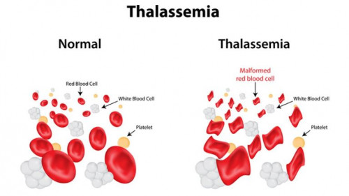 xet nghiem gen thalassemia 2