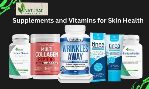 When it comes to skin health, Supplements and Vitamins for Skin Health can play a big role. Here are ten of the best supplements and vitamins for skin health. https://www.naturalherbsclinic.com/blog/top-10-best-supplements-and-vitamins-for-skin-health/