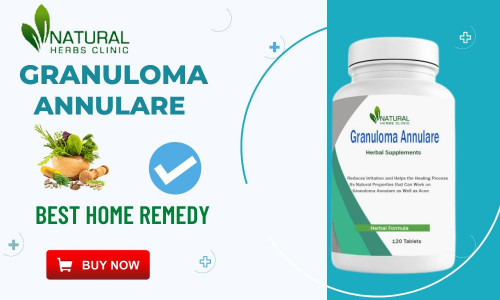 In this article, we will explore the Best Vitamins for Granuloma Annulare sufferers and how to incorporate them into your diet. https://ecopostings.com/the-best-vitamins-for-granuloma-annulare-sufferers/