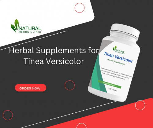 Tinea-Versicolor-Natural-Herbs-Clinic-offers-Home-Treatments-to-Recover-it.jpg