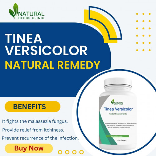 Tired of dealing with embarrassing tinea versicolor? Natural remedies may help! Check out our Natural Remedies for Tinea Versicolor and get back to your normal life. Our natural solutions are safe, effective, and available without a prescription. Get your healthy skin back with our natural remedies today.... https://www.naturalherbsclinic.com/product/tinea-versicolor/
