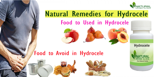 Use-Natural-Remedies-for-Hydrocele-to-Treat-it-Naturallycac03f648d3c9a5e.png