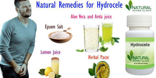 Consequently, the Epsom salt shower on more than one occasion is truly useful in disposing of hydrocele. The Natural Remedies for Hydrocele is in fact extremely beneficial and therefore decreases the expansion in one's scrotum... https://fediverse.blog/~/NaturalRemediesForHydrocele