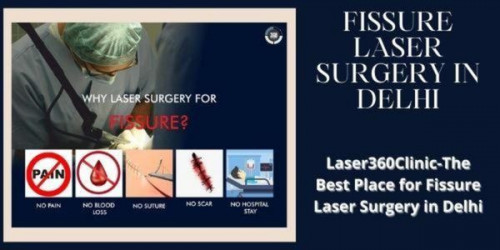 The recovery time of the fissure laser treatment in Delhi is very low. Usually, the patients can start their normal lifestyle after 24-48 hours of undergoing the treatment.
https://laser360clinic.com/laser360clinic-the-best-place-for-fissure-laser-surgery-in-delhi/