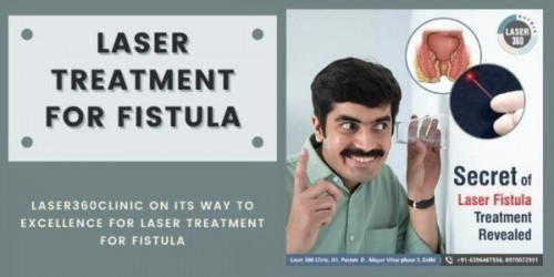 The clinic has been highly successful in bringing the best clinic that people prefer reaching whenever they look for the best fistula treatment in Delhi.
https://laser360clinic.com/laser360clinic-on-its-way-to-excellence-for-laser-treatment-for-fistula/