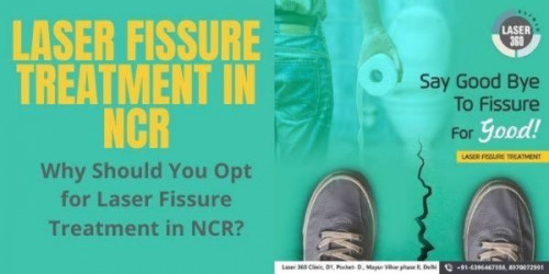 We at Laser360Clinic may recommend the best laser fissure treatment in NCR to stop the muscle spasms, thereby allowing the tear to heal.
https://laser360clinic.com/why-should-you-opt-for-laser-fissure-treatment-in-ncr/
