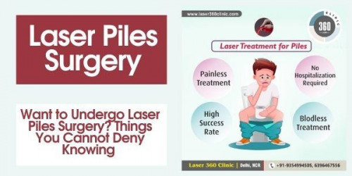 The patients must understand and accept that laser piles surgery is the most reliable as well as the most affordable treatment.
https://laser360clinic.com/want-to-undergo-laser-piles-surgery-things-you-cannot-deny-knowing/