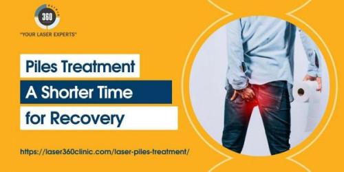 Laser Piles Treatment has no side effects, and this is the best treatment ever. The question of side effects arises in the mind of every patient.
https://laser360clinic.com/laser-piles-treatment-a-shorter-time-for-recovery/