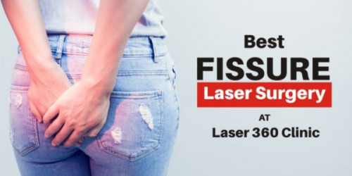 The available laser treatment for fissure and other diseases like this is very effective provided the patients try to reach the best clinic in Delhi NCR.
https://laser360clinic.com/laser-treatment-for-fissure-the-best-remedy-from-pain/
