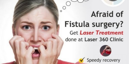 When it comes to getting the best laser treatment for fistula in Delhi, people often prefer reaching Laser 360 Clinic as it has the most outstanding facilities.
https://laser360clinic.com/how-does-laser-treatment-for-fistula-help-the-patients/