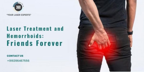 Hemorrhoid patients have benefited dramatically from laser treatments. This surgery is quite successful and affordable.
https://laser360clinic.com/laser-treatment-and-hemorrhoids-friends-forever/