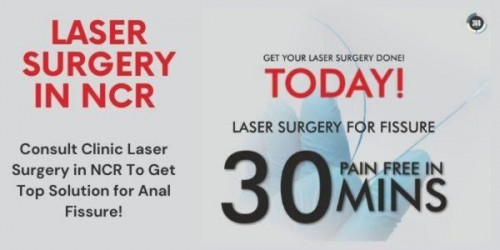Laser surgery in NCR is the standard treatment for fissures that reduced the risk of recurrence.
https://laser360clinic.com/consult-clinic-laser-surgery-in-ncr-to-get-top-solution-for-anal-fissure/