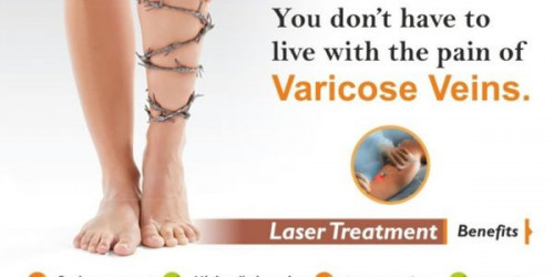 The patients are free from any worries regarding the best varicose veins laser treatment cost. It is a great advantage for every patient.
https://laser360clinic.com/everything-you-should-know-about-varicose-veins-treatment/